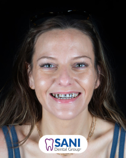 Before from Lisa J. Moses